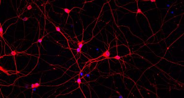 Una proteína que en exceso termina asociada a enfermedades neurodegenerativas